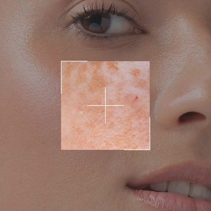 NUEVO Suero despigmentante - MATCHA SPOT CORRECTING SERUM